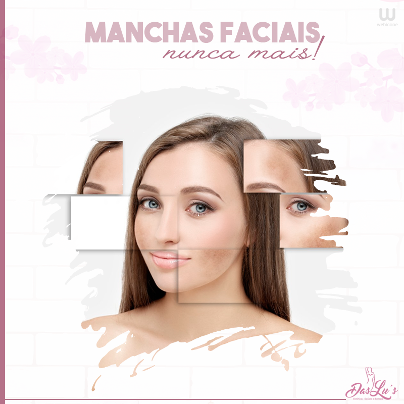 Manchas Faciais – DASLUS